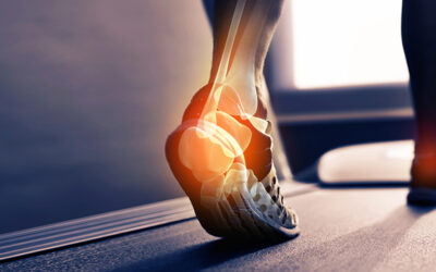 Heel Pain? Here is what you need to know about Severs