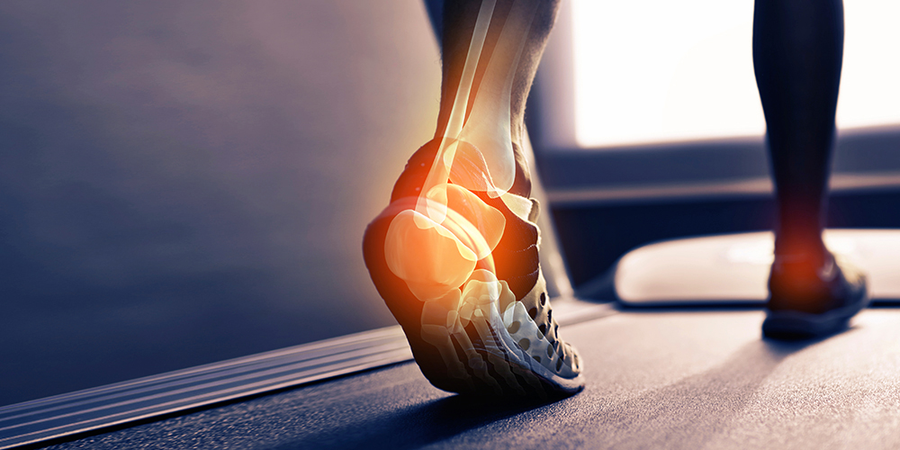 Heel Pain? Here is what you need to know about Severs